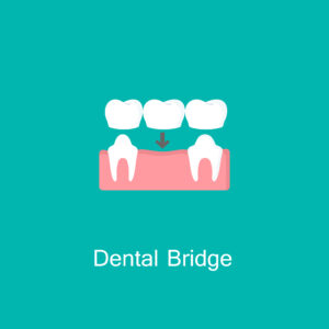 Dental crown and bridge